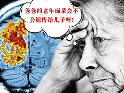 老年癡呆癥會(huì)不會(huì)遺傳?